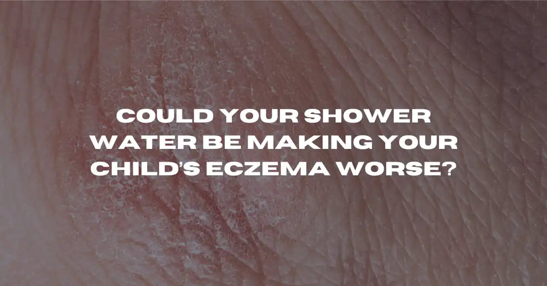 Is Your Shower Water Triggering Your Child's Eczema? What Australian Parents Need to Know - Flowy Australia