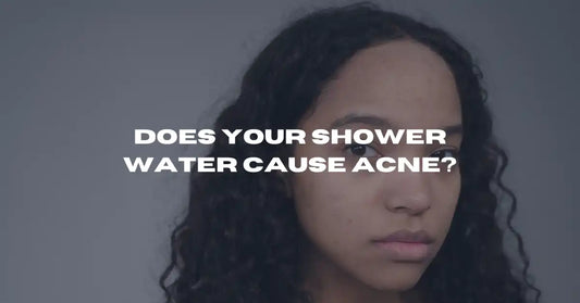 Does Your Shower Water Cause Acne? What Australian Tap Water Is Doing to Your Skin