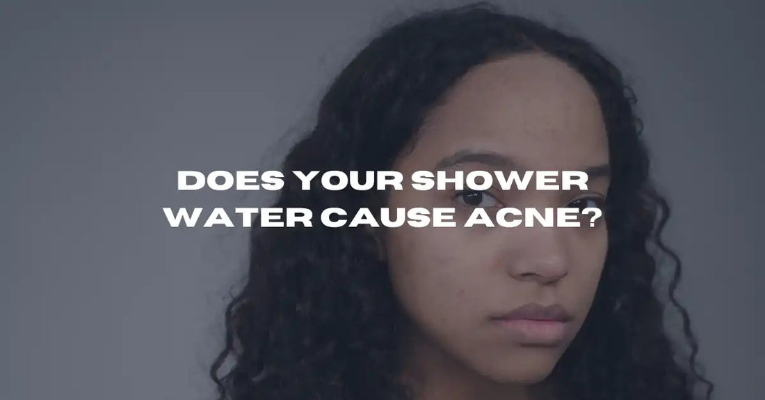 Does Your Shower Water Cause Acne? What Australian Tap Water Is Doing to Your Skin - Flowy Australia